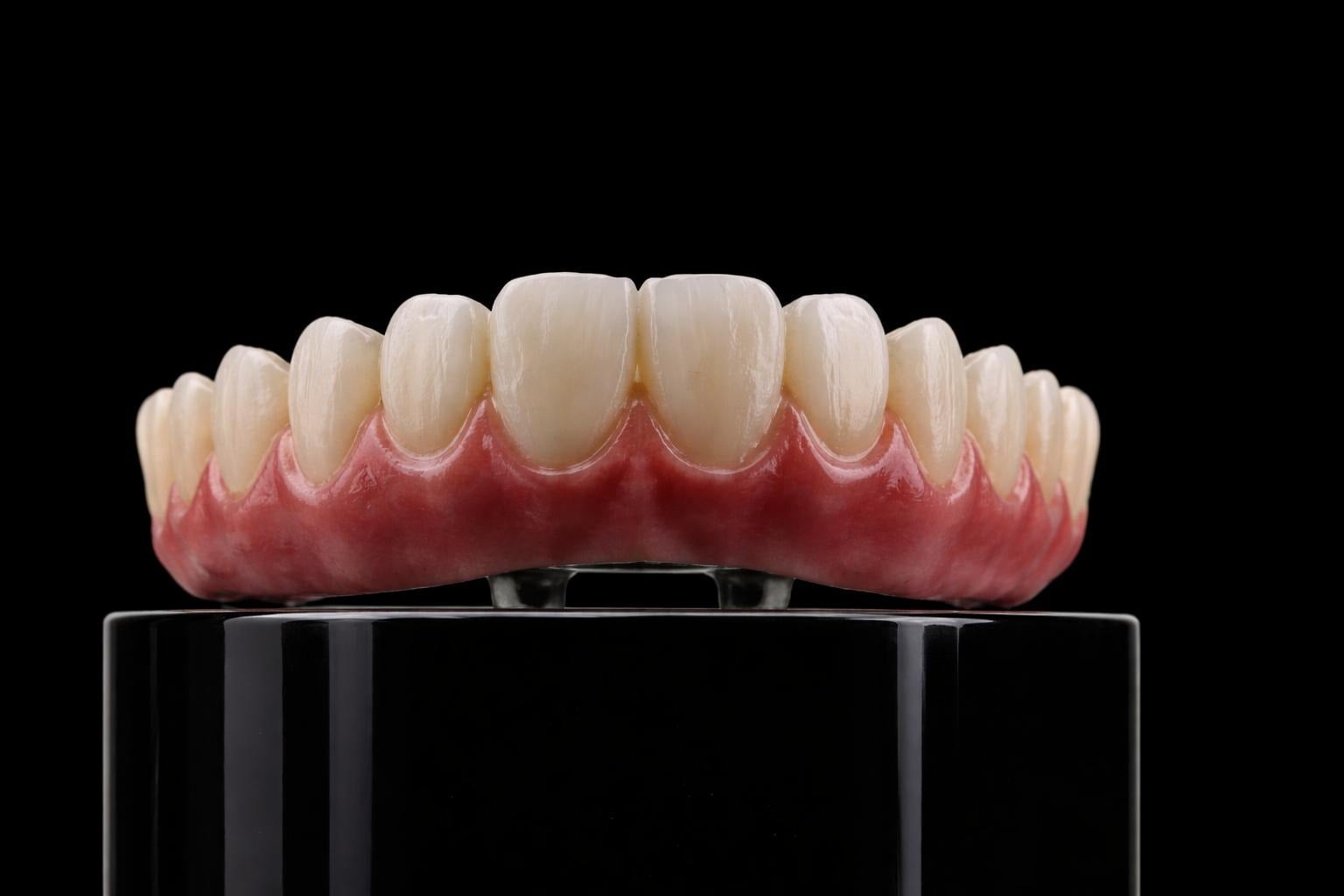 All-on-X Restorations