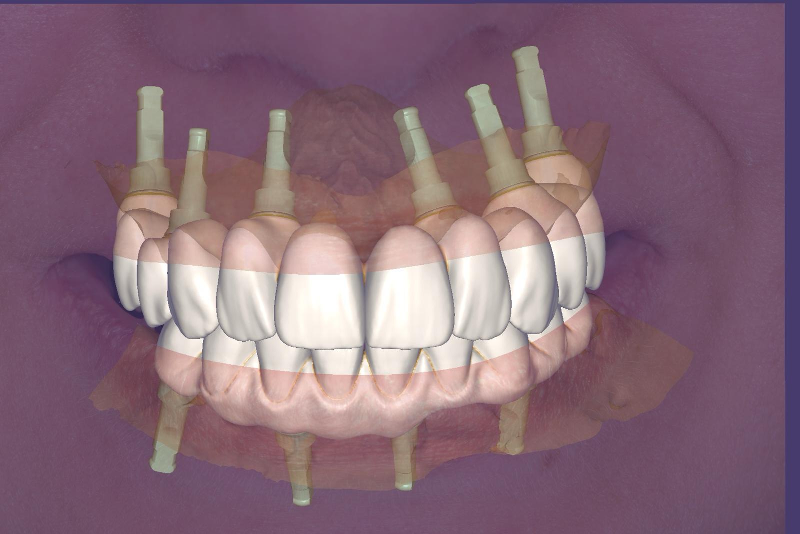 CAD-Design Perspektive