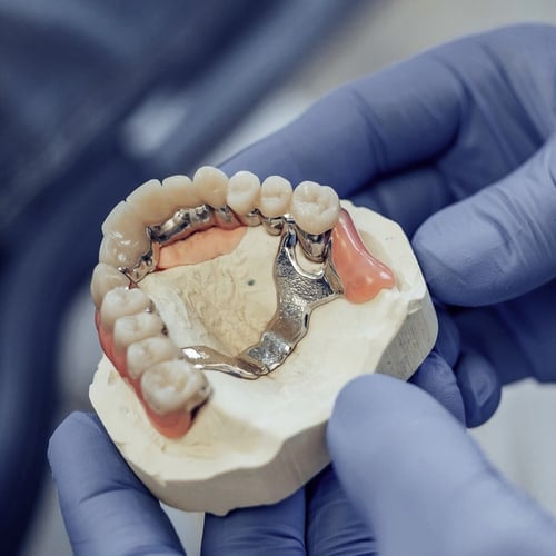 Removable Prosthetics